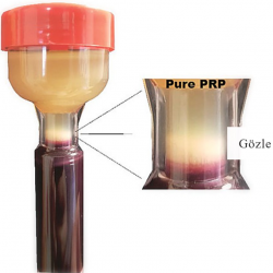 PRP KİT (platelet rich plasma) 