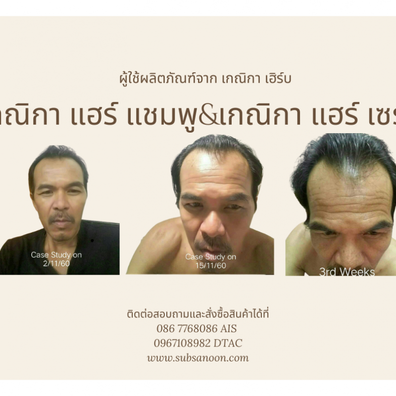 Сыворотка для волос Kenika купить оптом - компания Kenika Herb | Таиланд